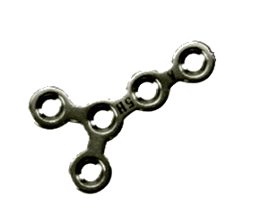 Mini Y plate maxillofacial surgery for screws 1.5 mm