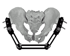 Large pelvic external fixator