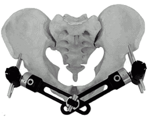 Small pelvic external fixator